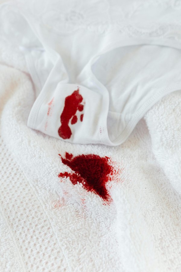 Culotte menstruelle ado : tout savoir sur le remboursement en 2024
